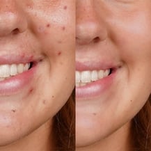 Retouching